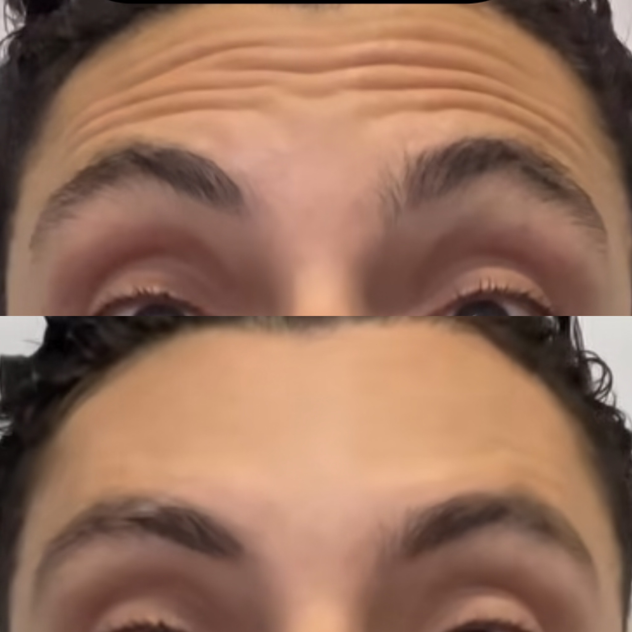 Cosmiatria — antes e depois